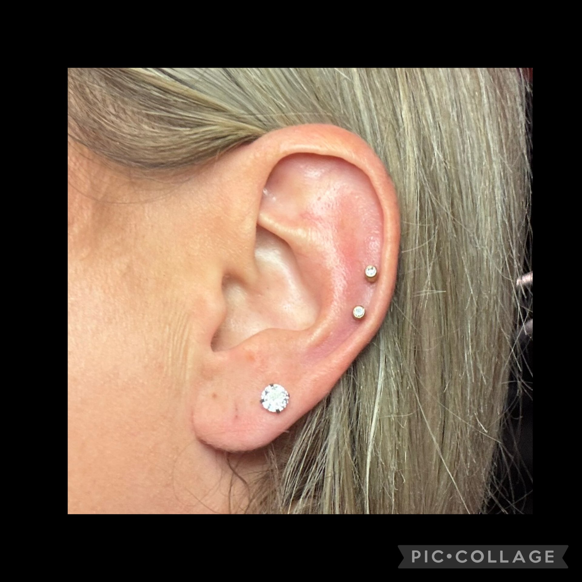 Blomdahl Medical Piercings treatment photograph
