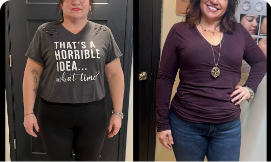 Client-provided before-and-after weight-loss photograph